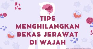 Cara Menghilangkan Bekas Jerawat di Wajah